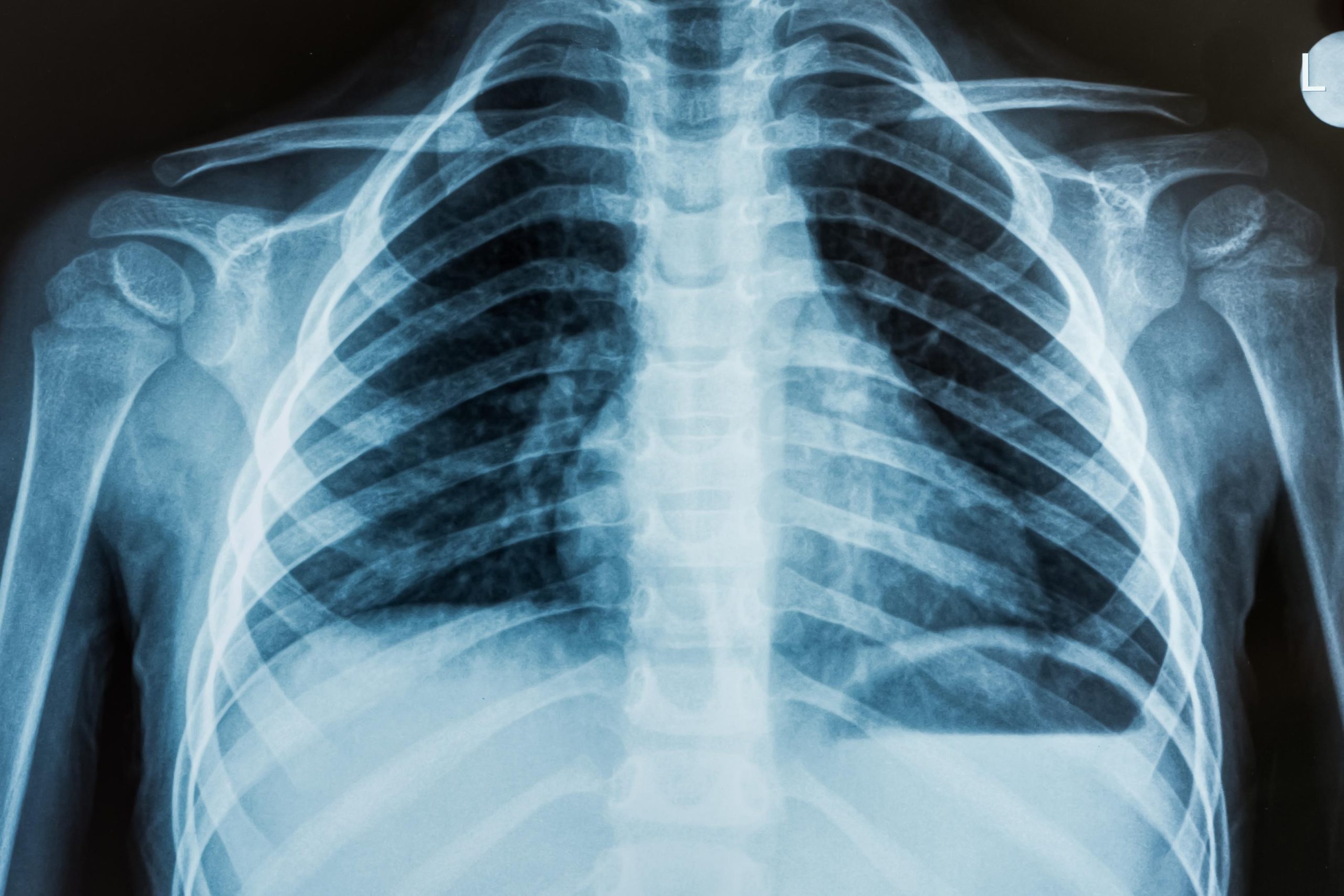 Xray_share Xray_share